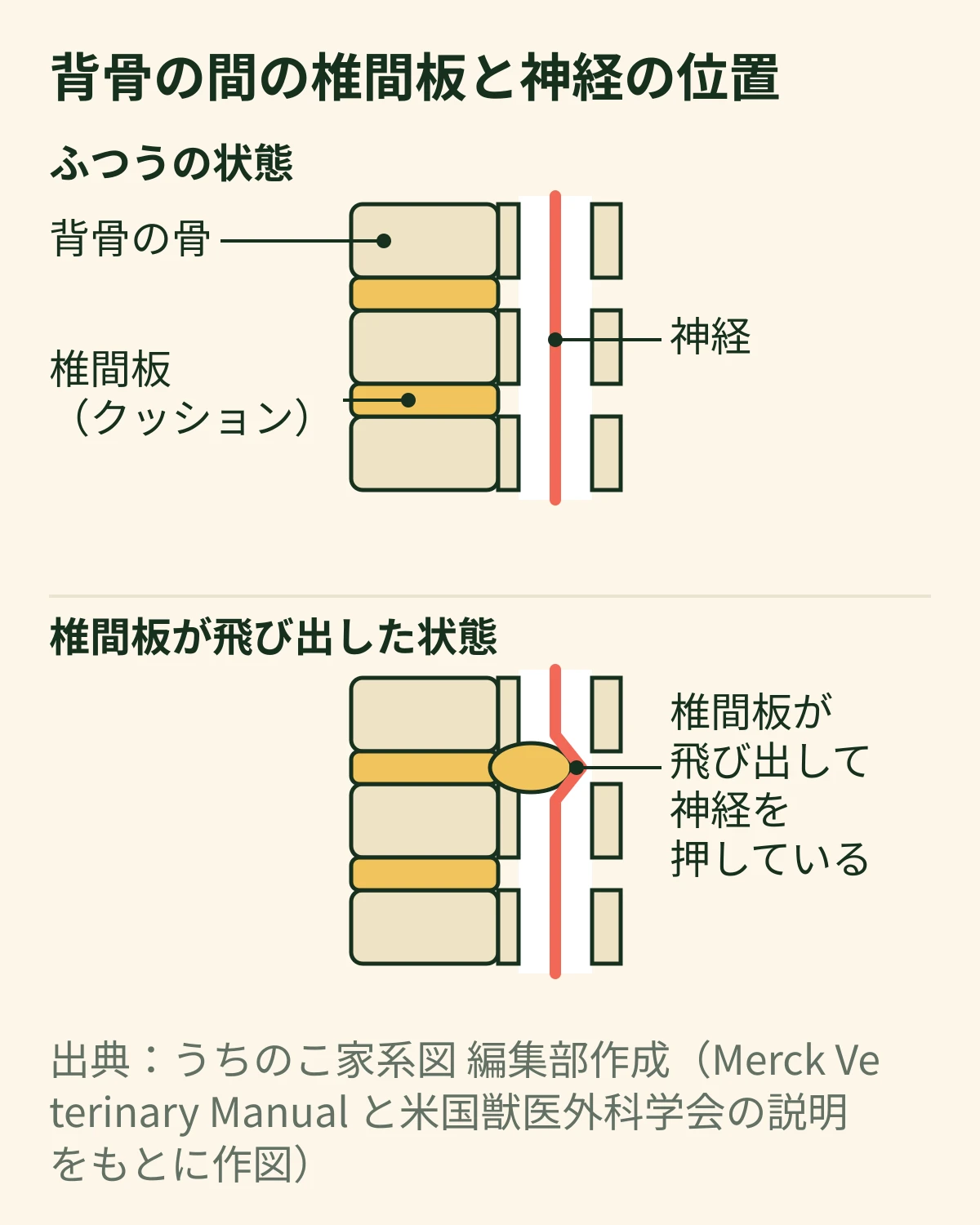 犬の背骨の断面の模式図。上段はふつうの状態で、骨と骨の間に椎間板(クッション)があり、その上を神経が通る。下段は椎間板が飛び出して神経を押している状態